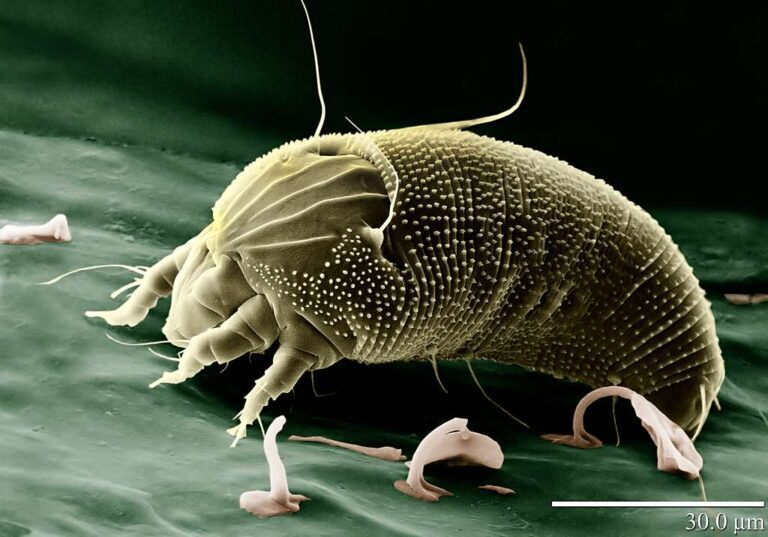Effective Strategies to Control Dust Mites in Your Home