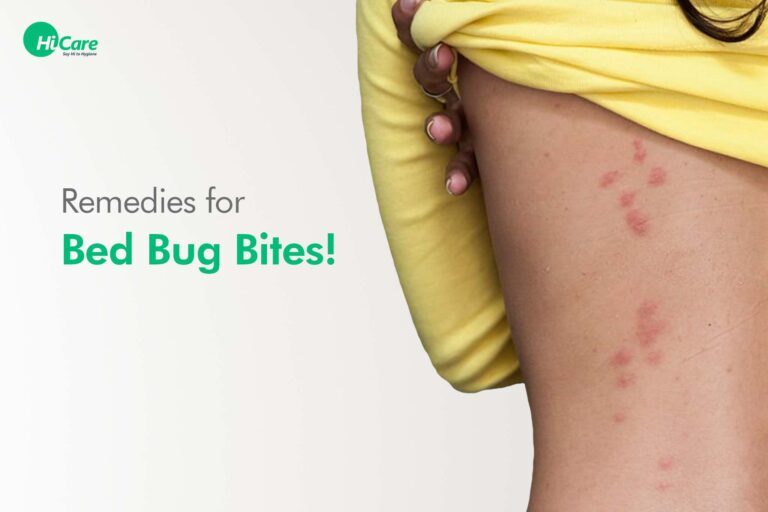 Dealing with Bed Bug Bites: Remedies and Relief